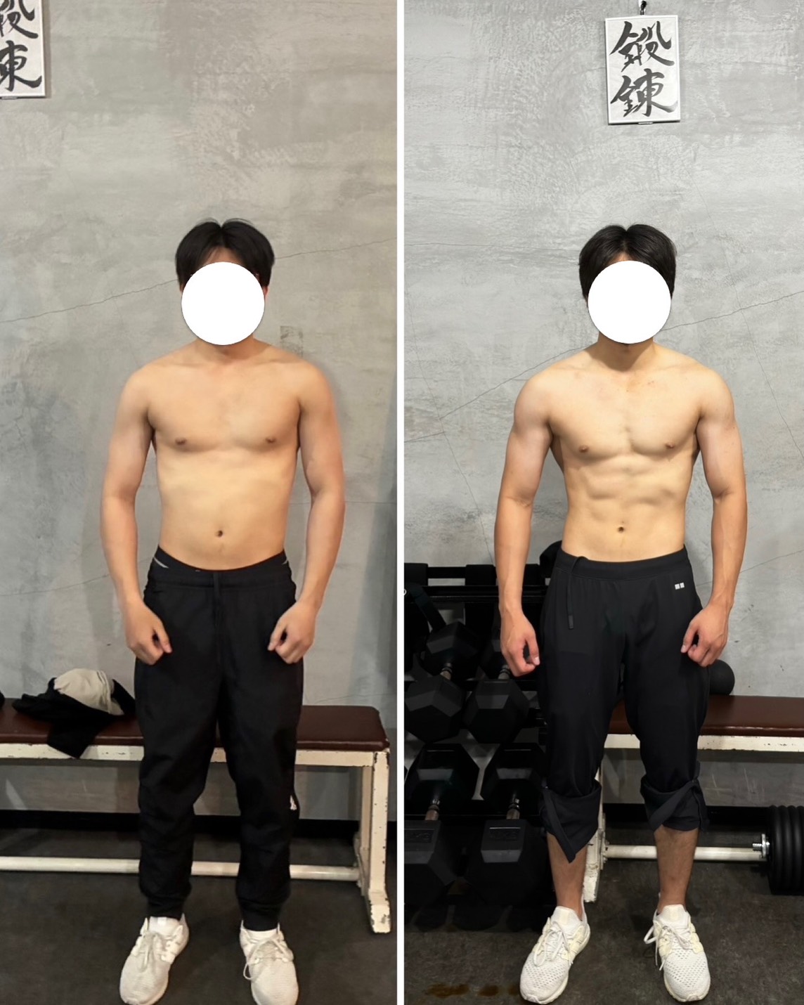 Case04 Before/After 正面